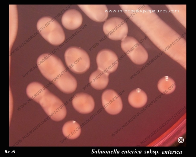 salmonella mucoid colonies on Endo